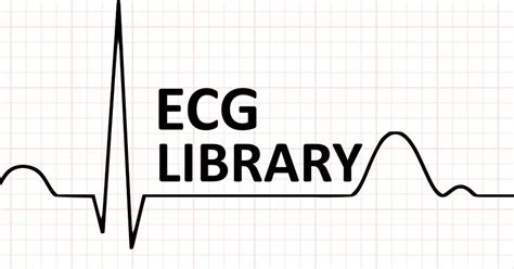 chloe ecg torrent|ecg library pdf.